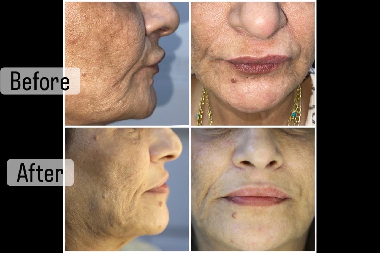 علاجات الوجه التجميلية
